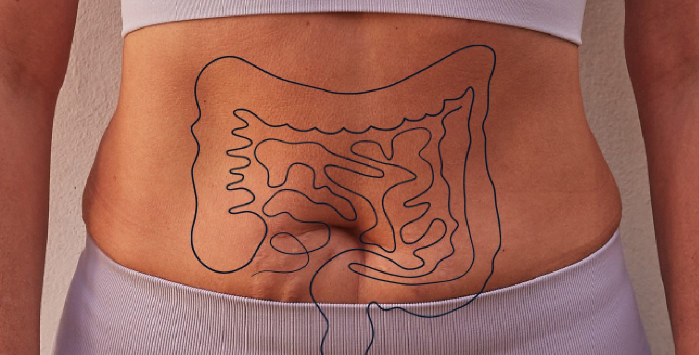 Darm Health Check